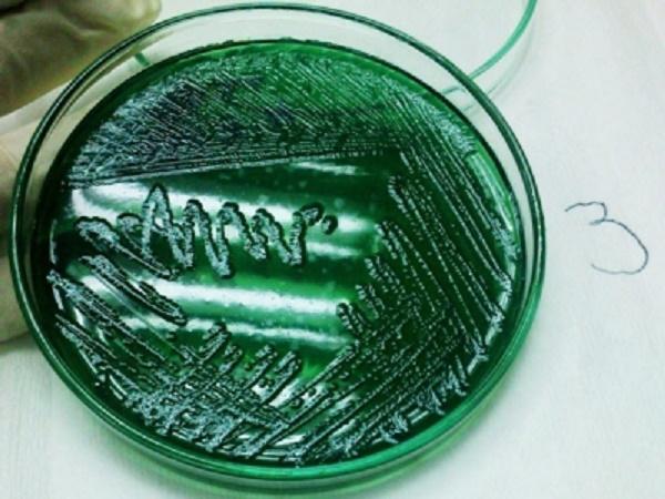 NT-Cẩn trọng với loại vi khuẩn mới gây bệnh trên thủy sản